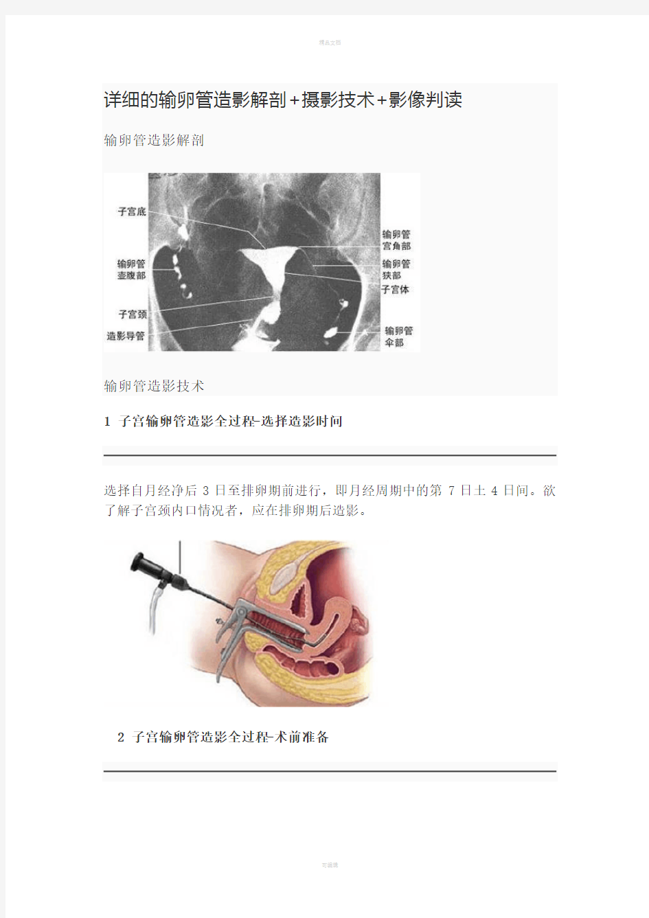 详细的输卵管造影解剖+摄影技术+影像判读