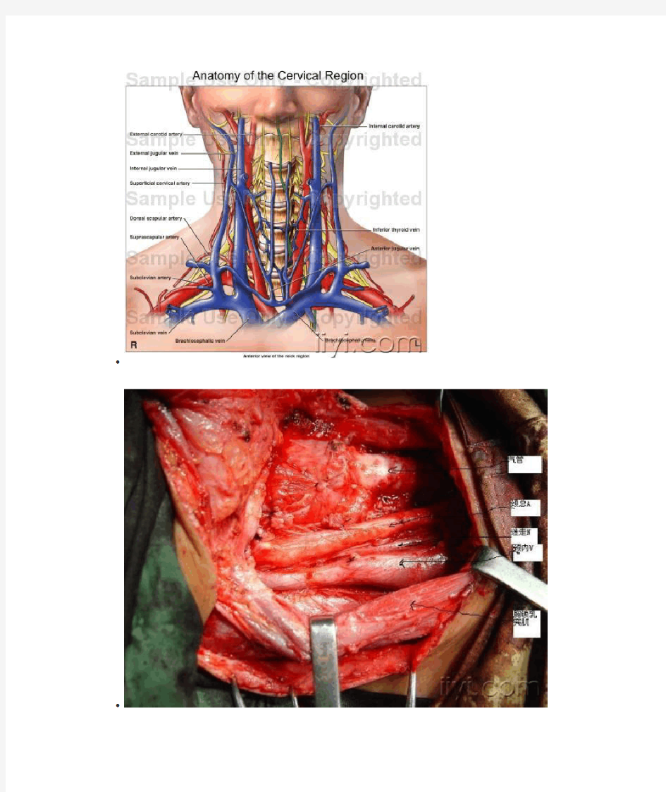 颈内静脉置管术图解