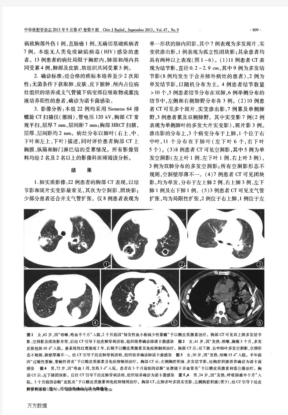 肺部诺卡菌感染的胸部CT特点