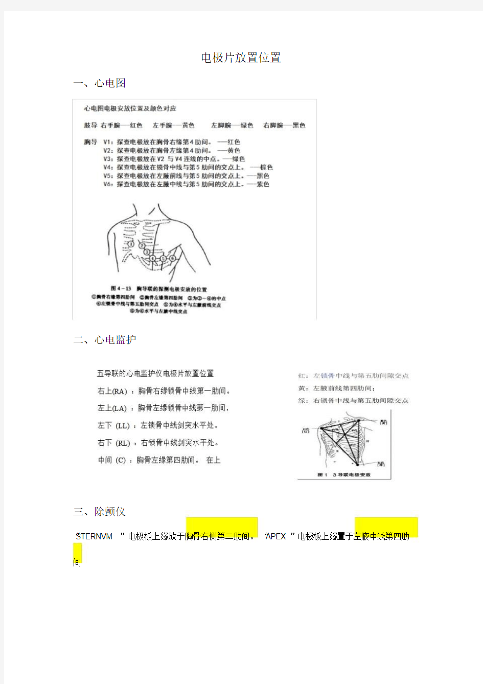 电极片放置位置