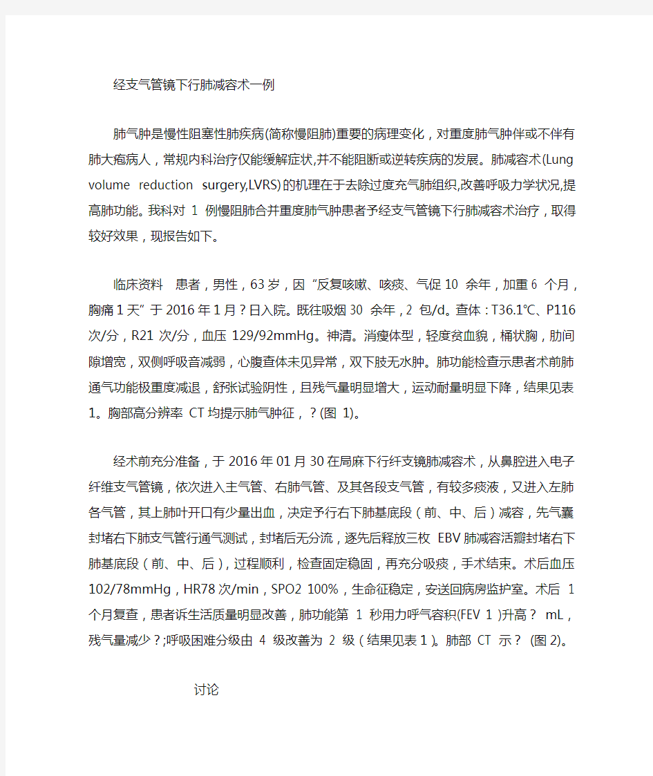 经支气管镜肺减容术治疗肺气肿一例