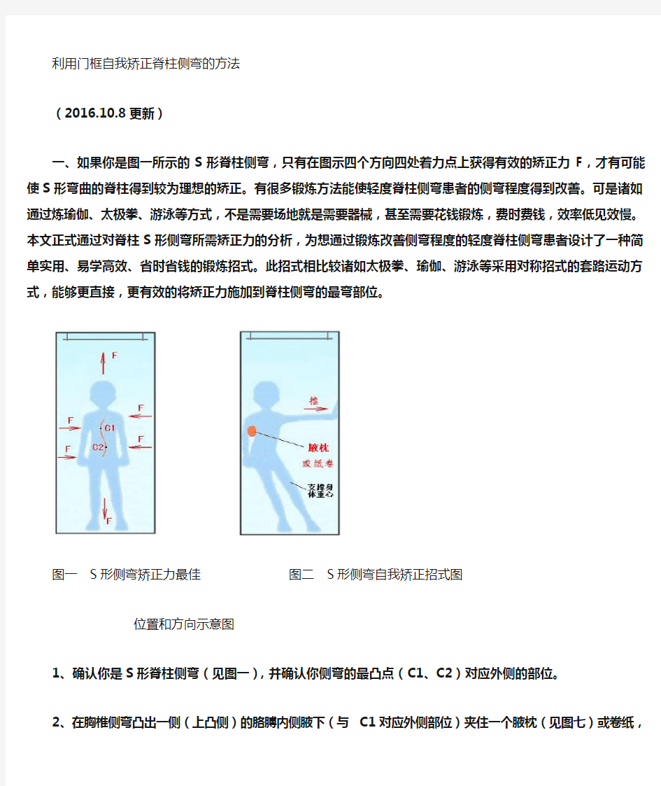 脊柱侧弯自我矫正方法