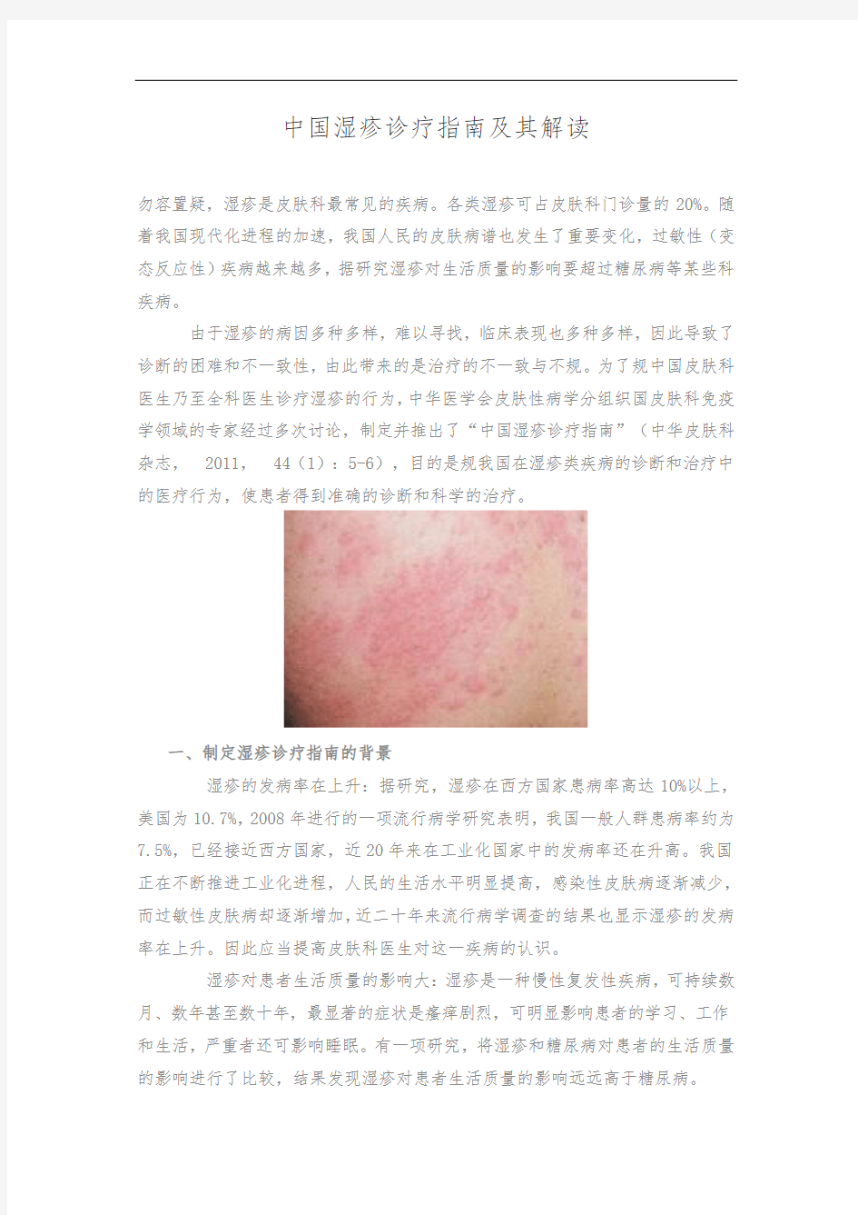 中国湿疹诊疗指南及其解读--张建中