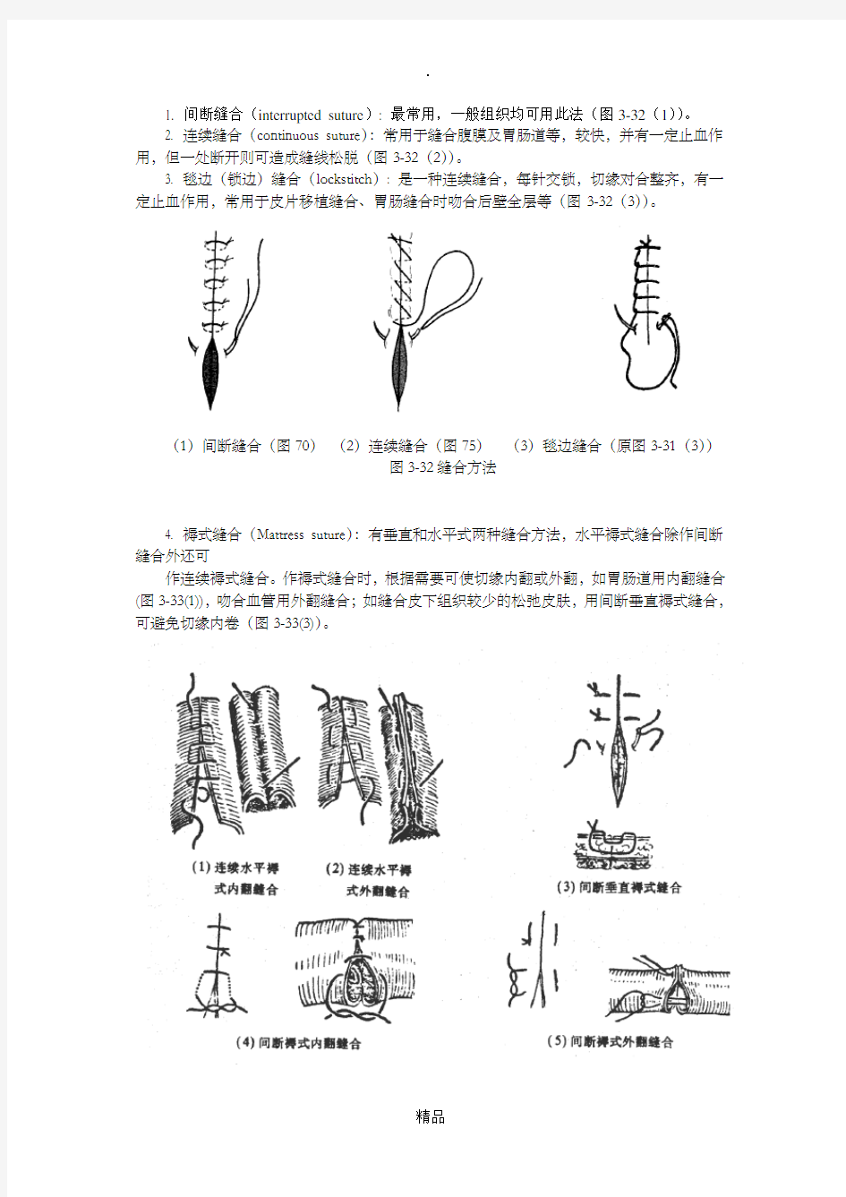 常用的缝合方法