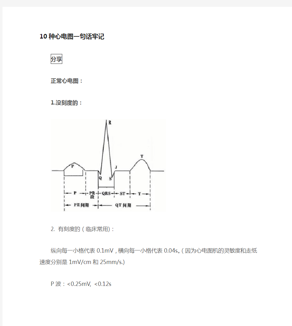 心电图口诀