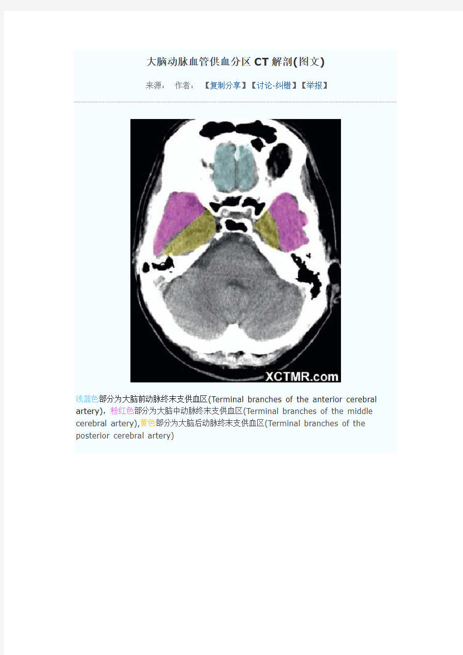 大脑动脉血管供血分区CT解剖(图文)