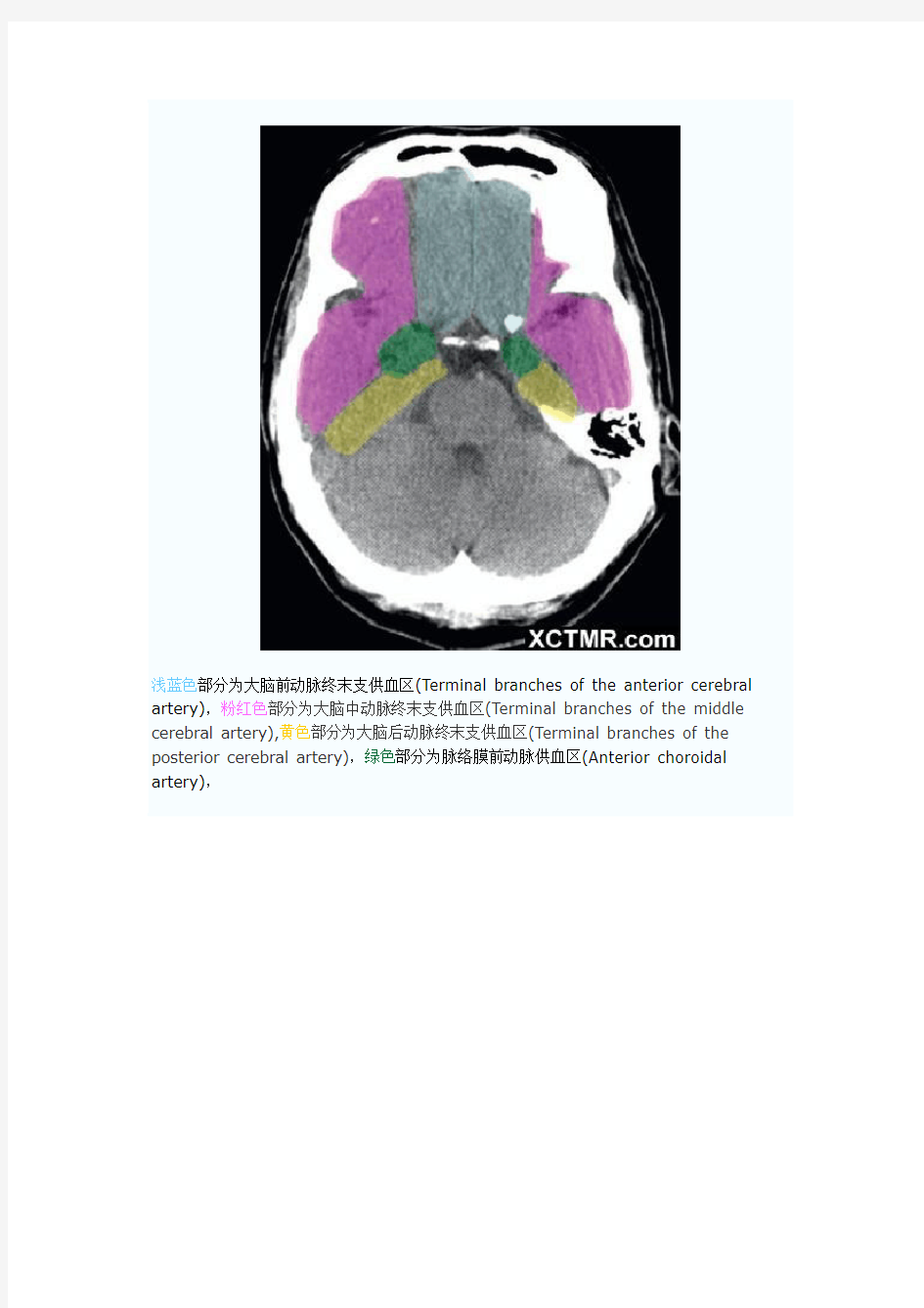 大脑动脉血管供血分区CT解剖(图文)