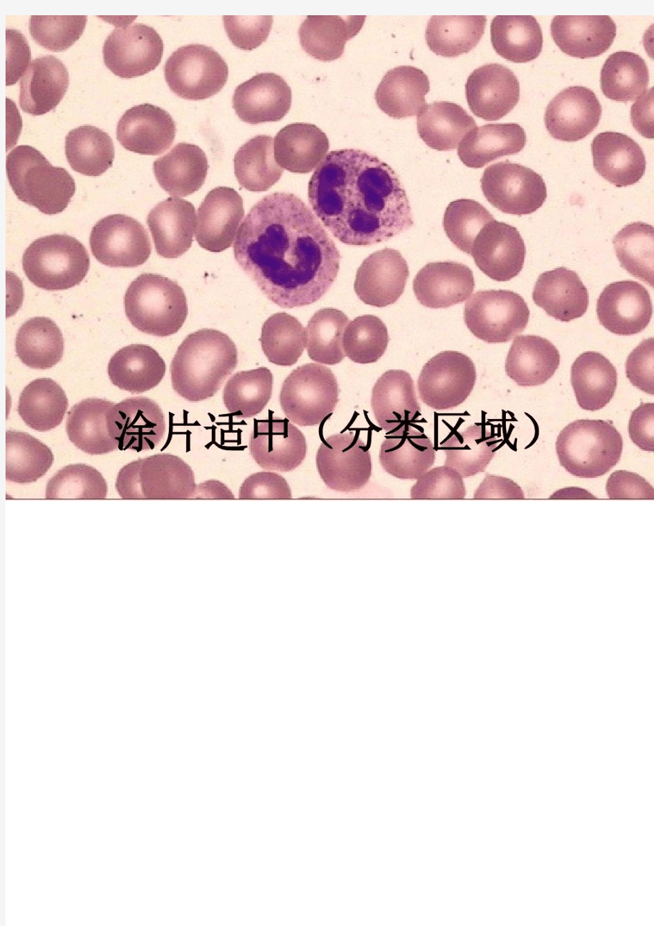 血细胞图谱大全