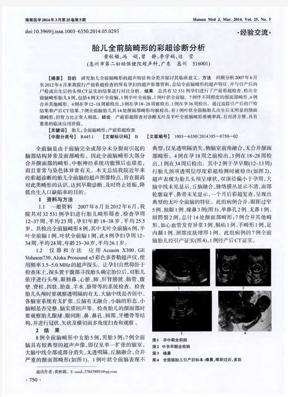 胎儿全前脑畸形的彩超诊断分析