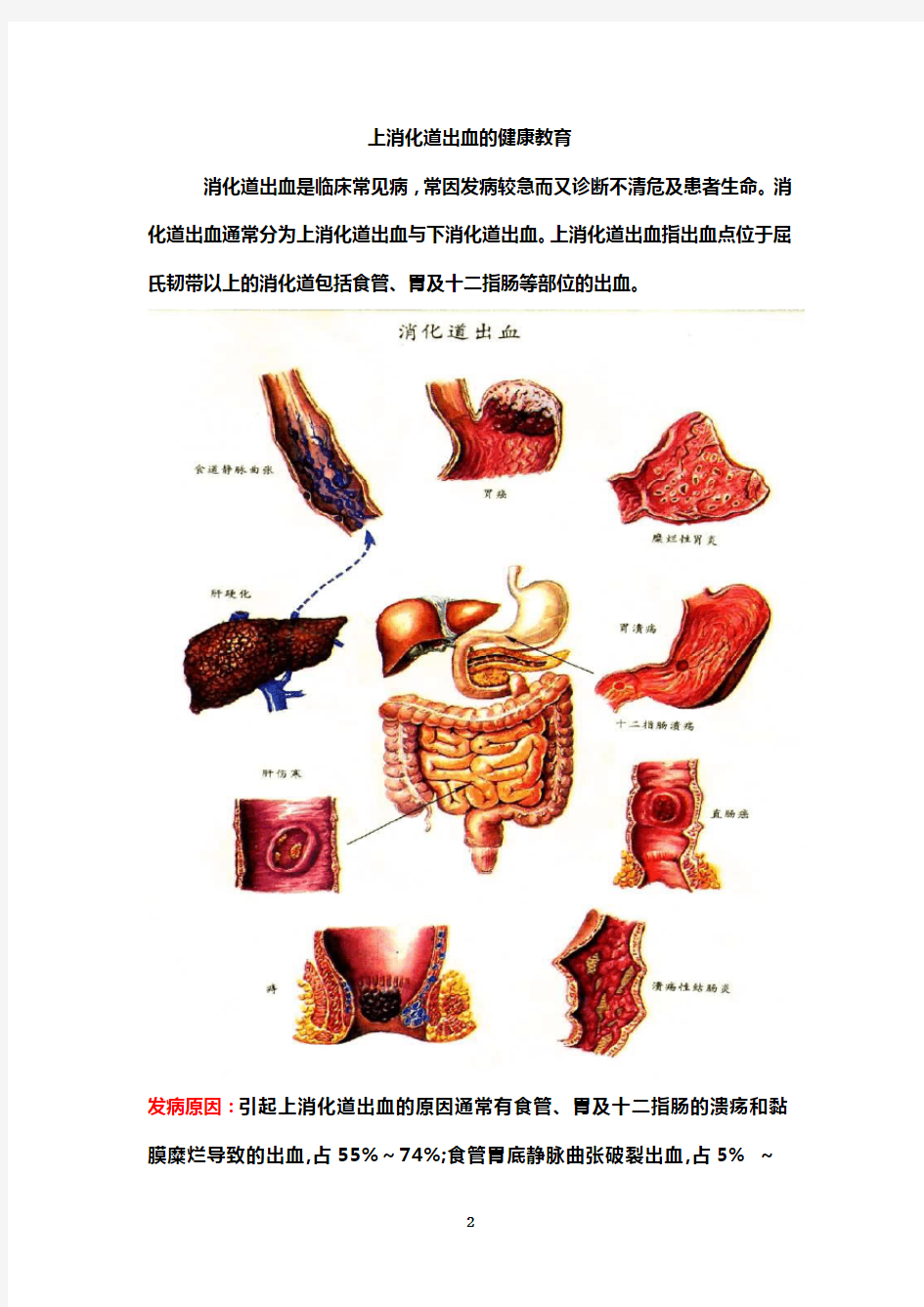 上消化道出血健康教育