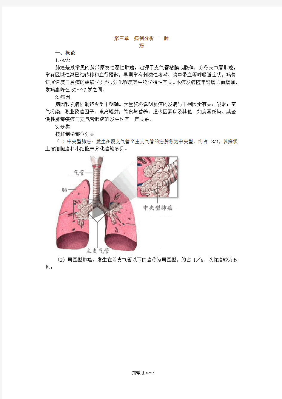 病例分析——肺癌