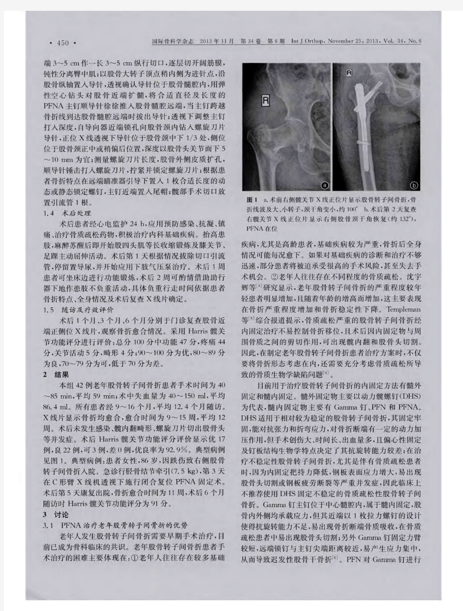 防旋型股骨近端髓内钉治疗老年股骨转子间骨折疗效分析