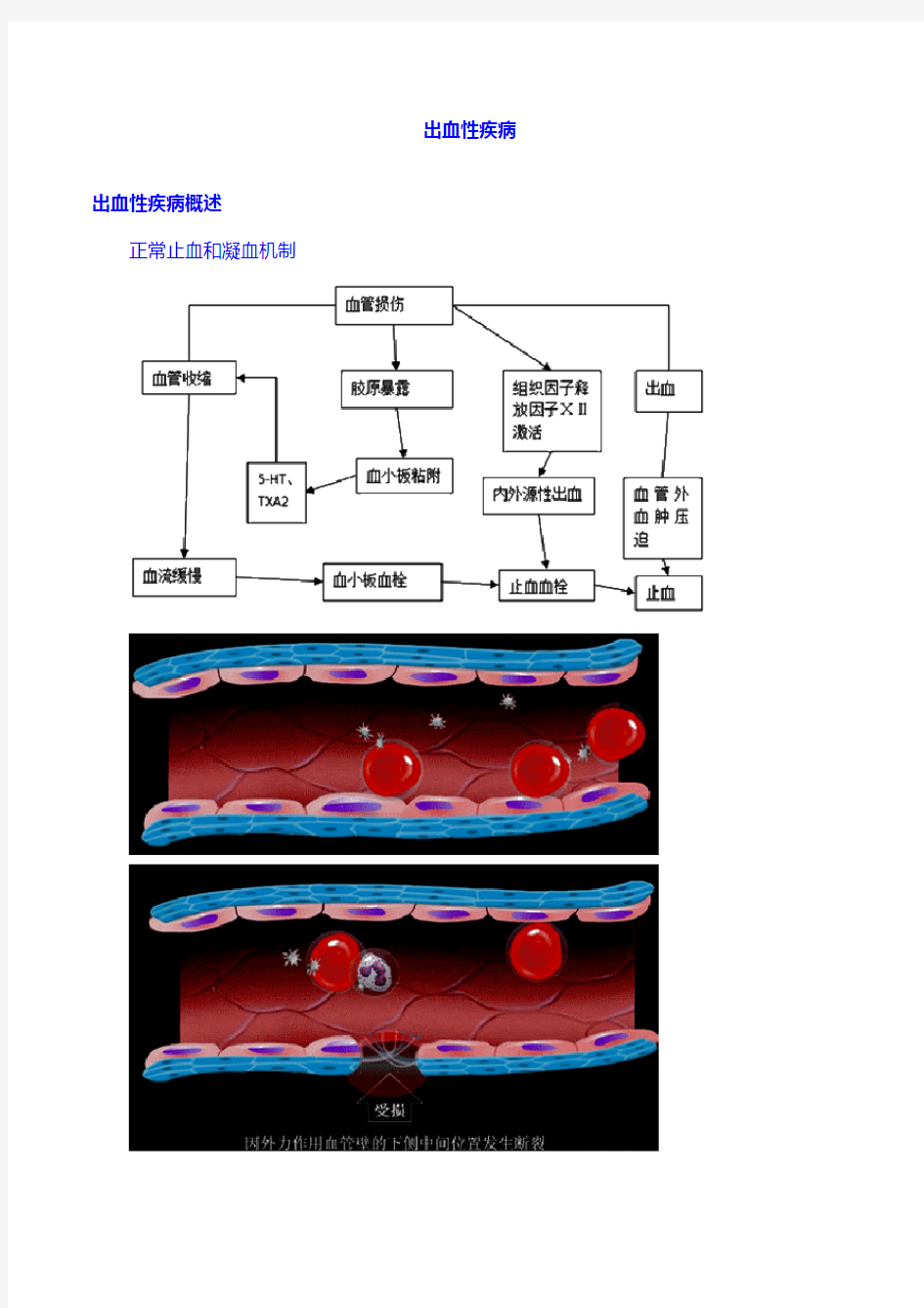 内科 专业 ：29.出血性疾病