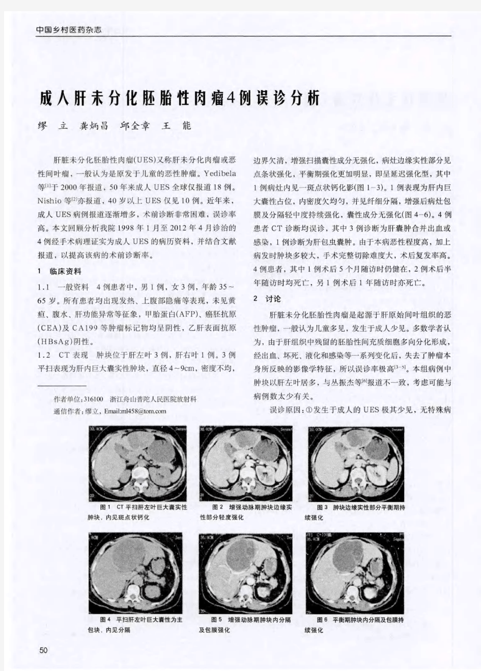 成人肝未分化胚胎性肉瘤4例误诊分析