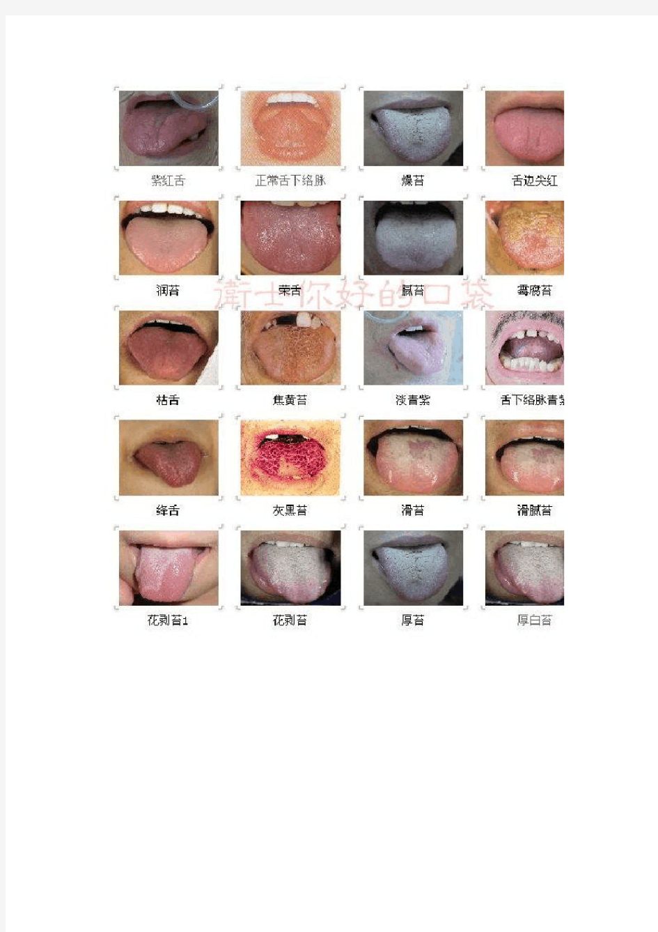 中医舌诊图谱