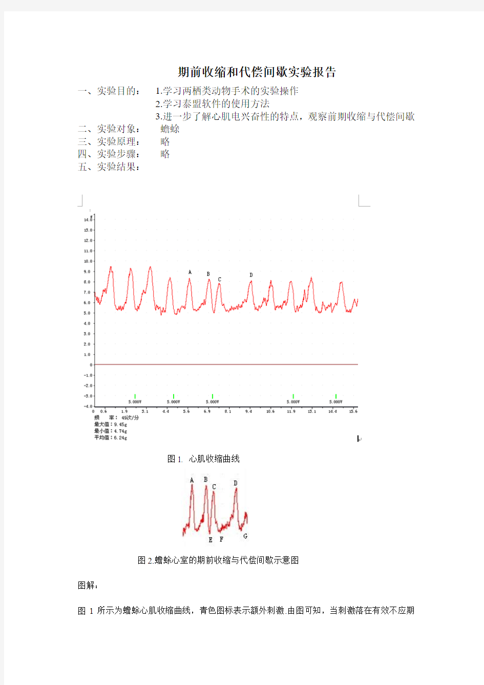 期前收缩与代偿间歇实验报告