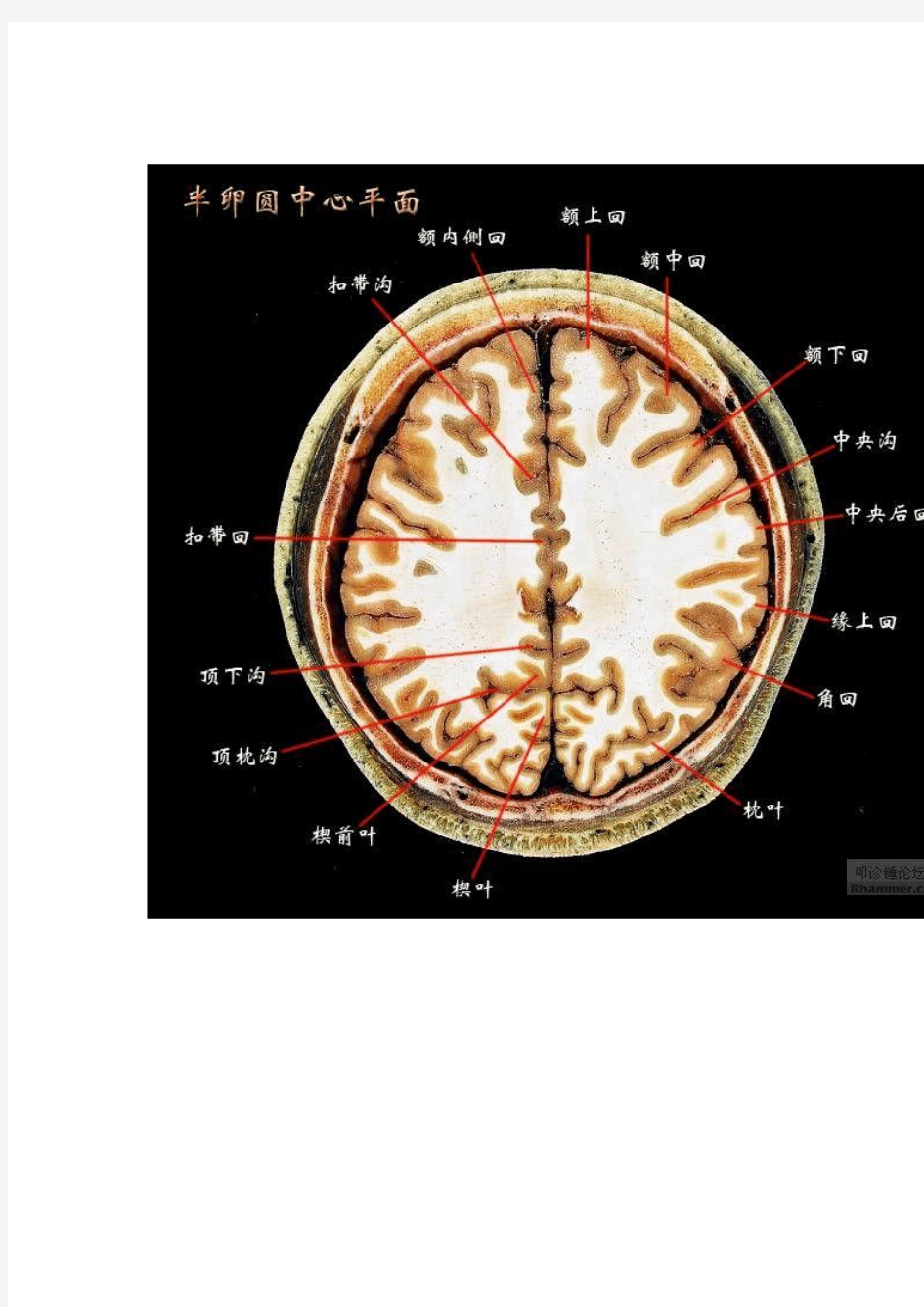 脑部解剖图