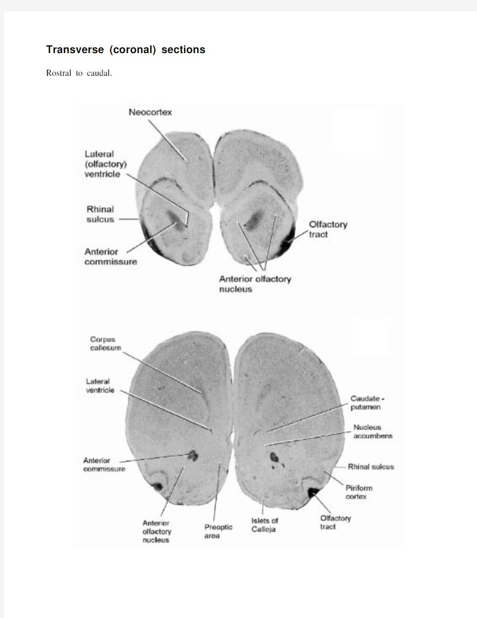 大鼠大脑解剖图
