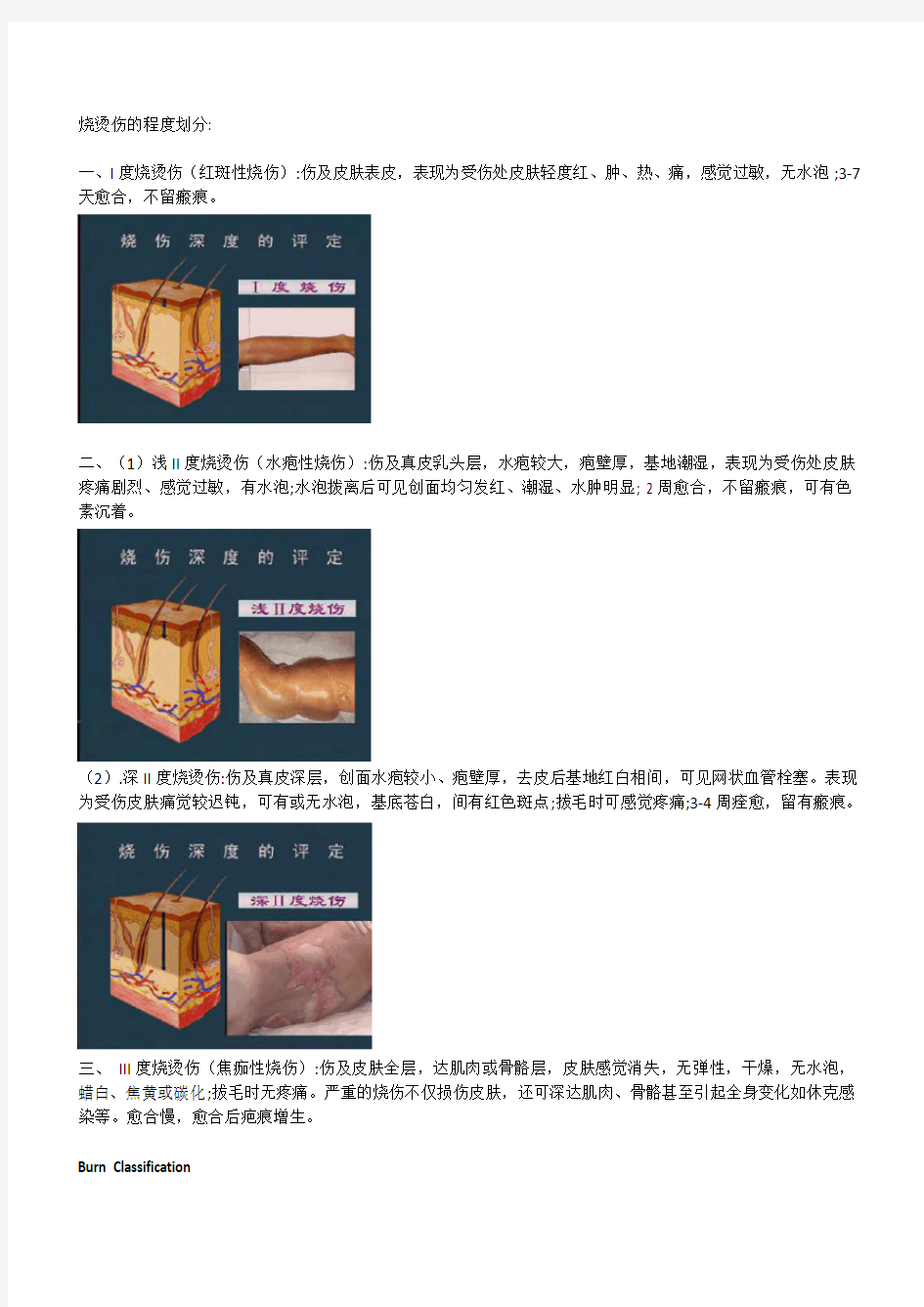 烧烫伤的程度划分 中英文