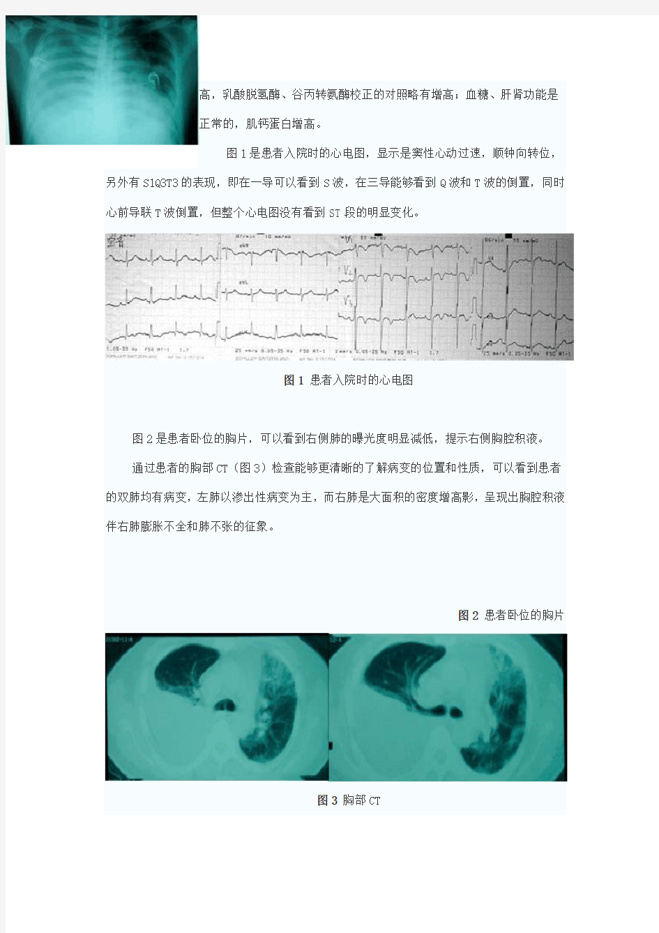 肺血栓栓塞症并发症的识别与处理