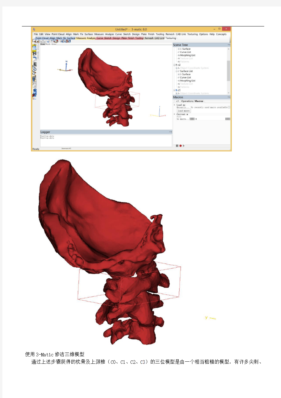 mimics颈椎建模详细过程