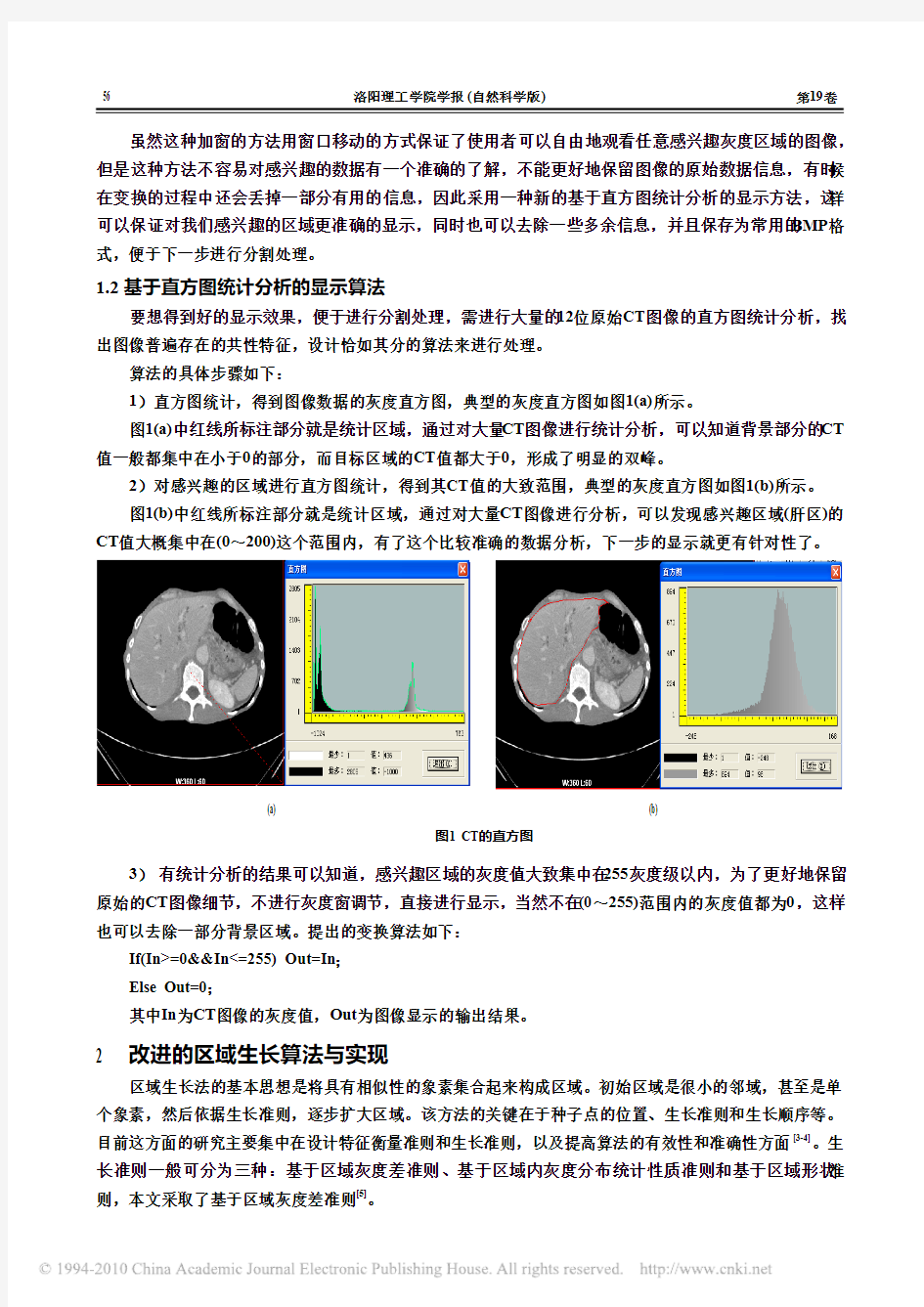 基于CT图像分析和区域生长法的CT图像分割