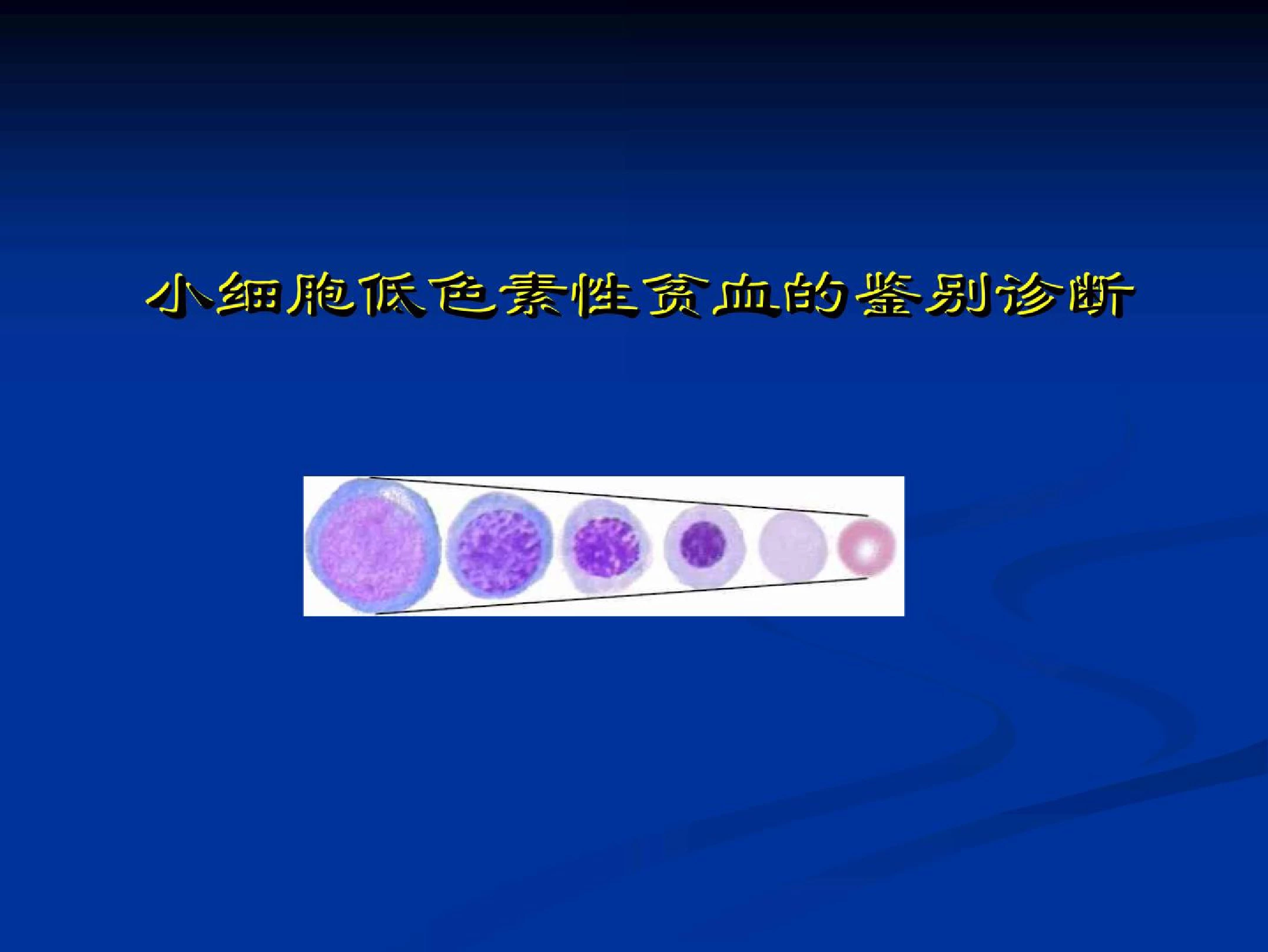 诊断学 实验诊断 小细胞低色素性贫血的鉴别诊断