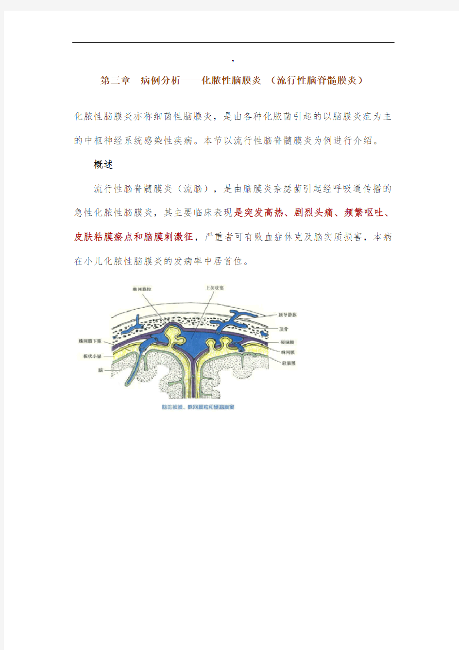 第三章-病例分析——化脓性脑膜炎-(流行性脑脊髓膜炎)-执业医师实践技能强化精讲课程讲义