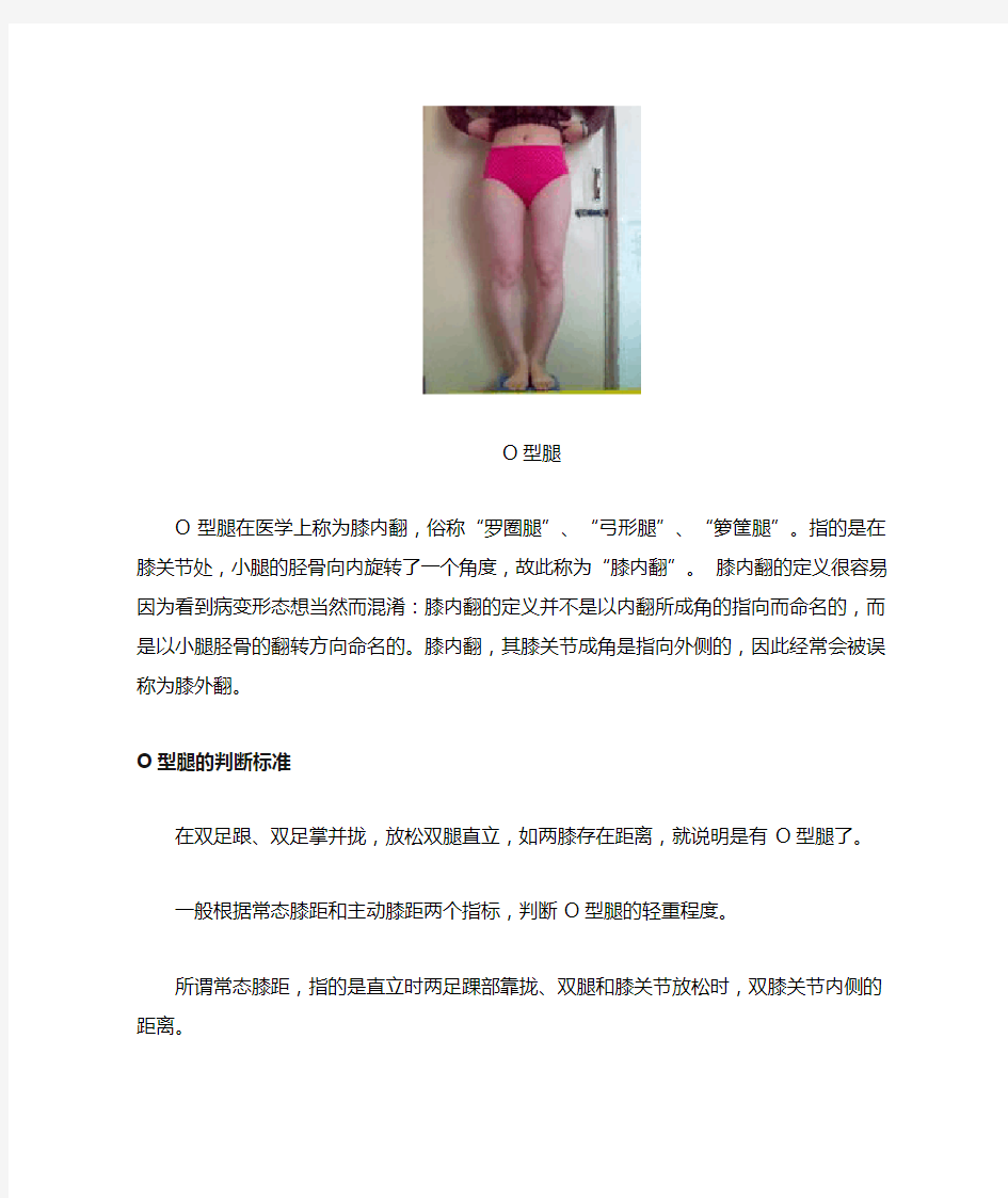 O型腿和X型腿的矫正方法