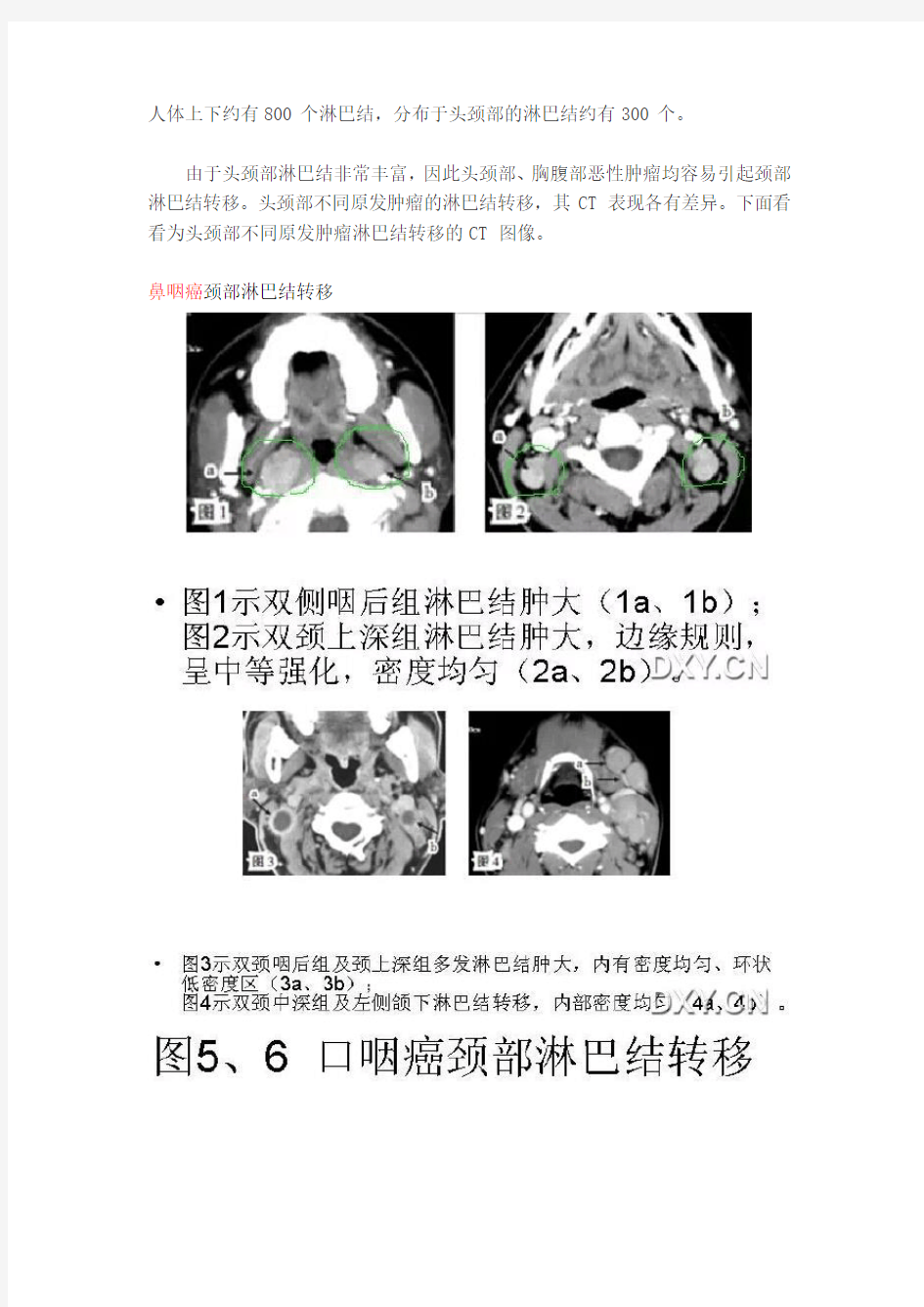 头颈部淋巴结肿大的诊断要点