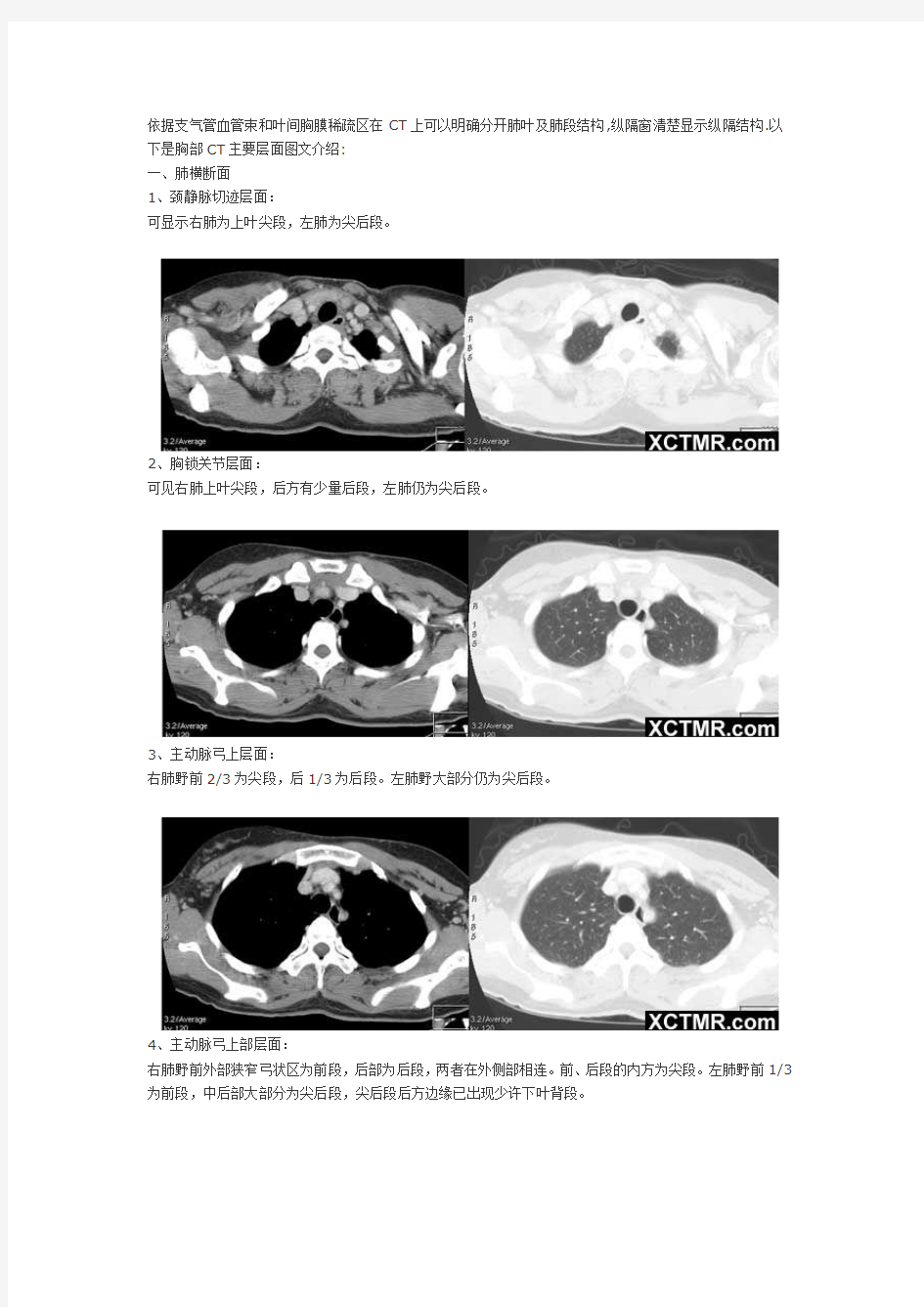 胸部CT断层解剖