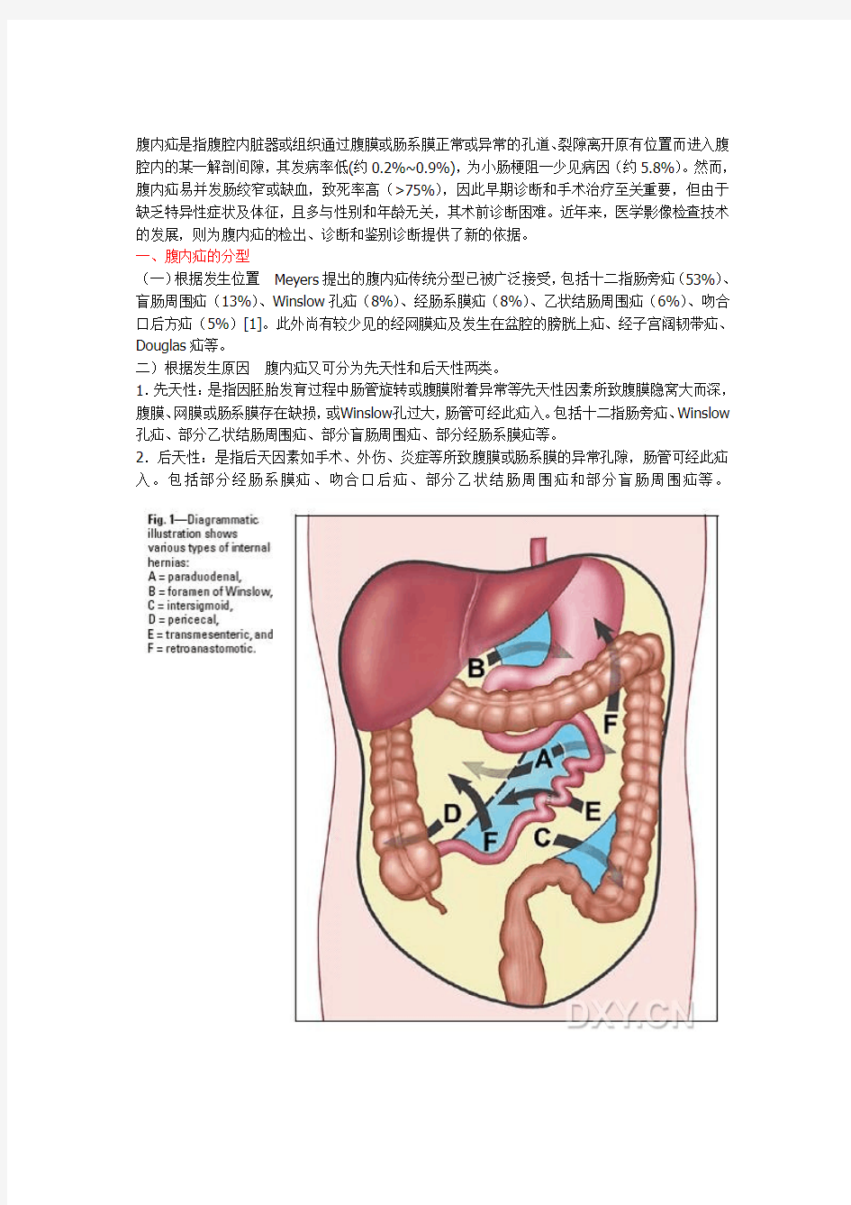 (仅供参考)腹内疝的影像诊断