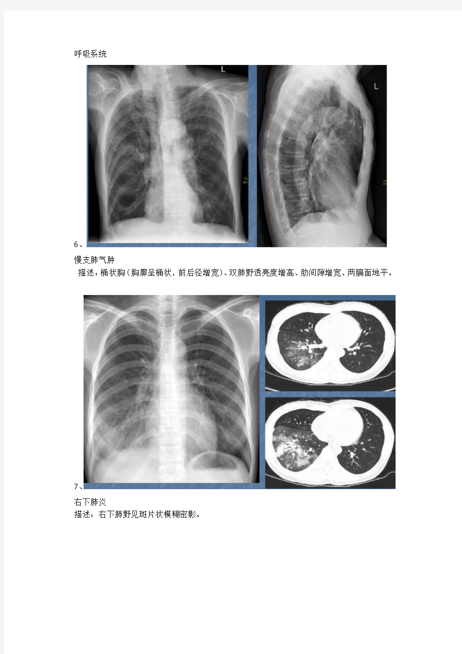 呼吸系统影像学