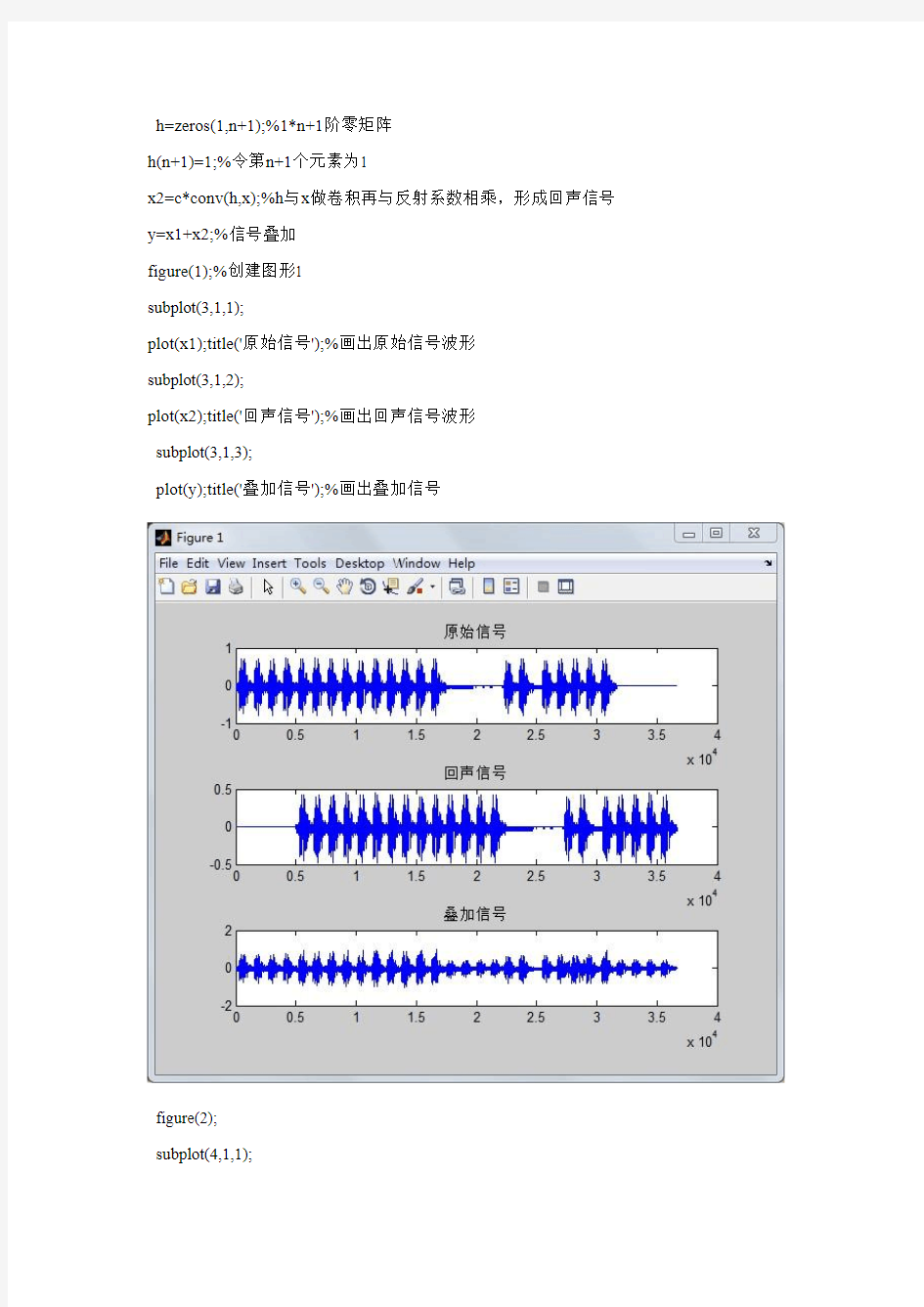 回波的产生与消除