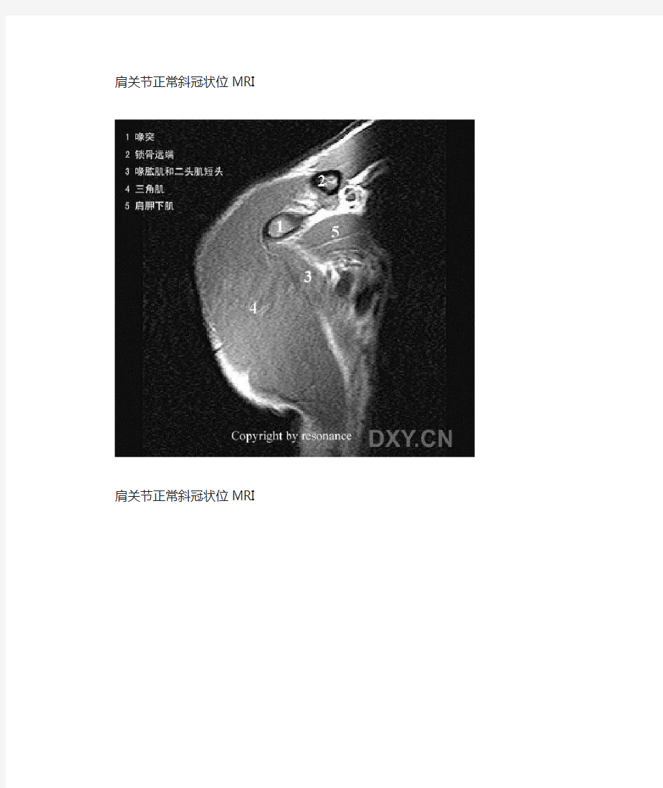 肩关节正常MRI解剖图谱