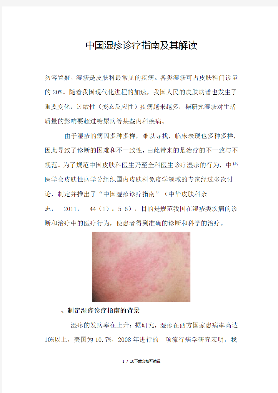 中国湿疹诊疗指南及其解读