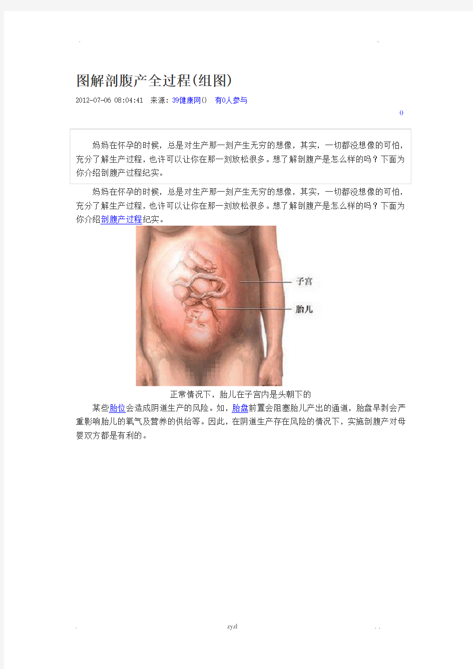 图解剖腹产全过程(组图)