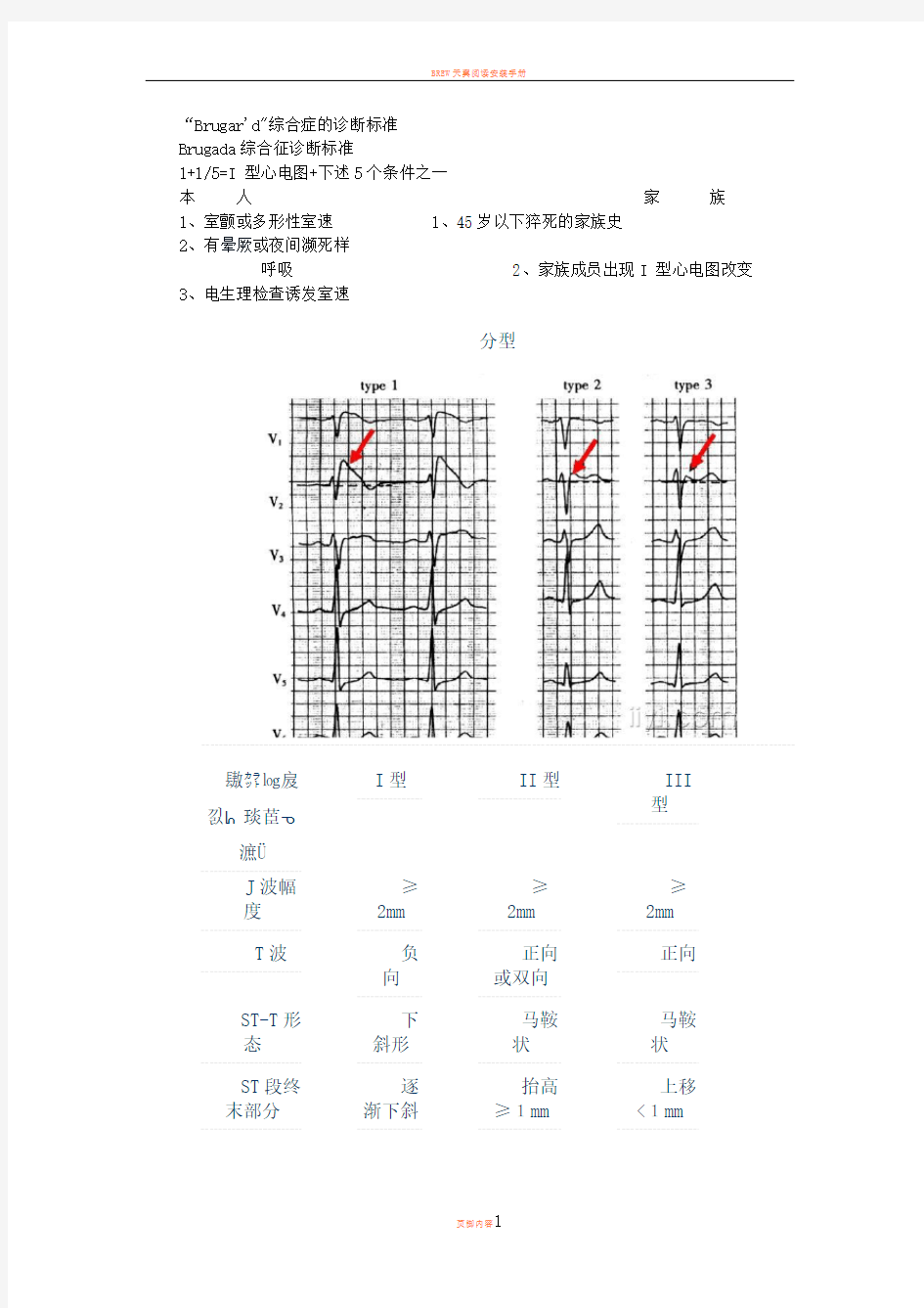 Brugada综合征诊断标准