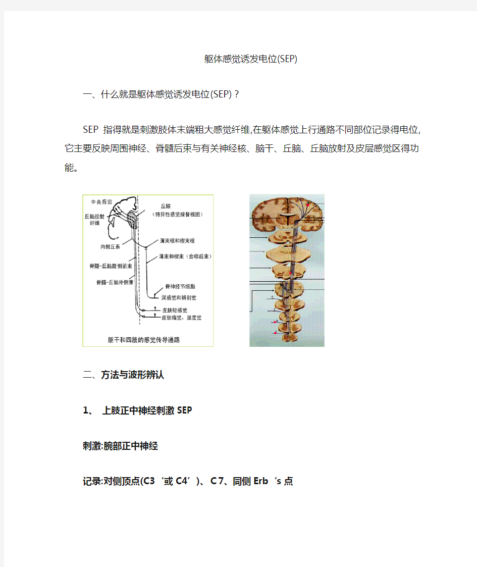 体感诱发电位