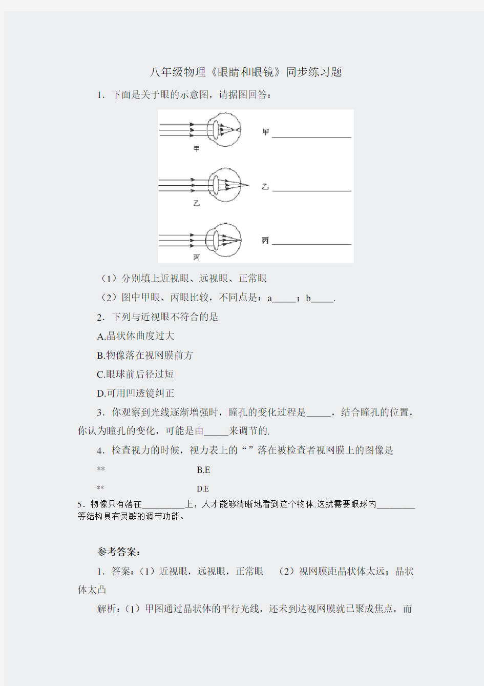 人教版初中物理-54眼睛和眼镜练习含答案