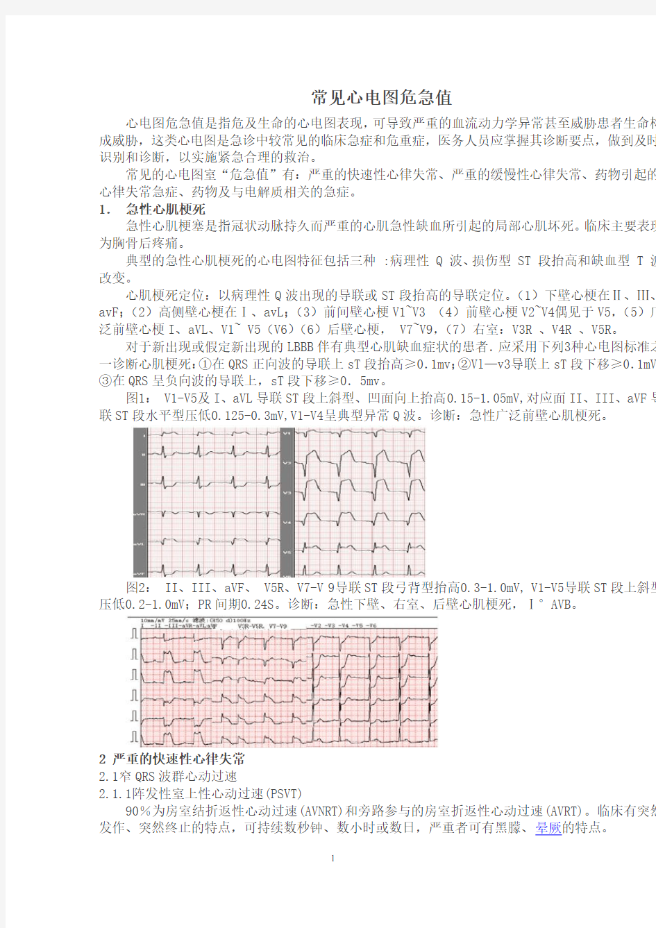 常见的心电图“危急值”