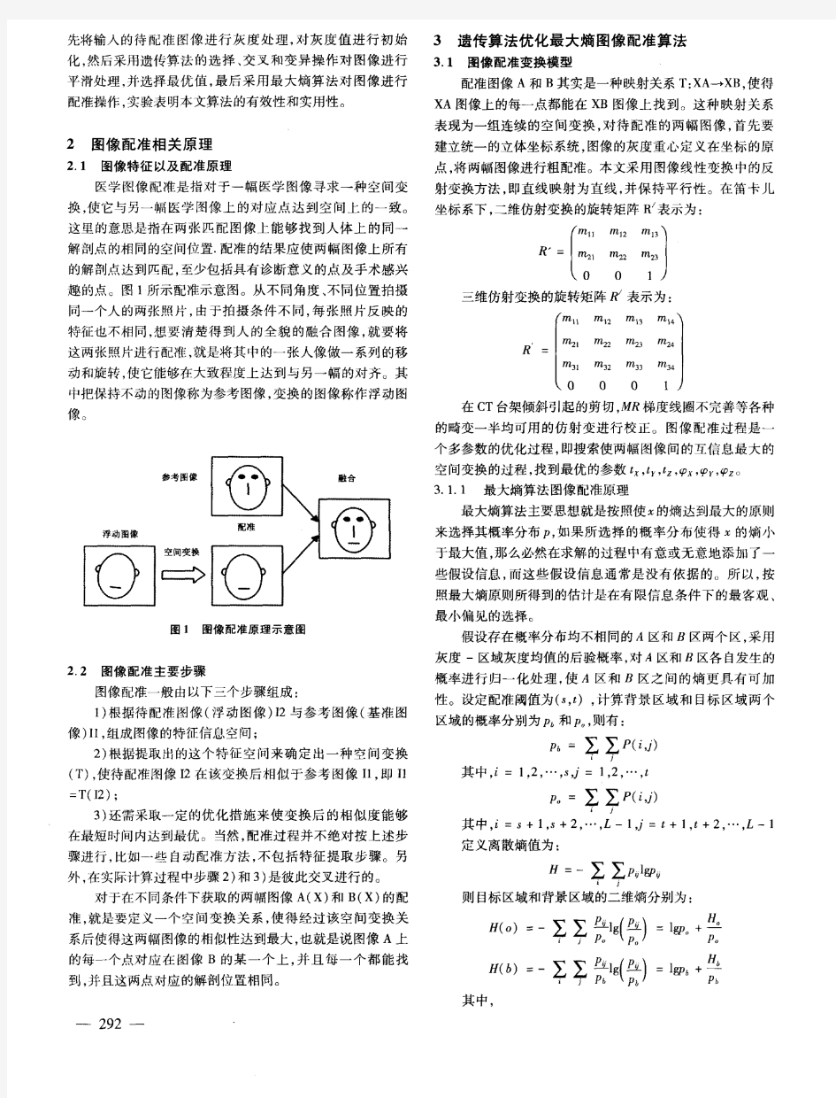 医学图像配准算法研究