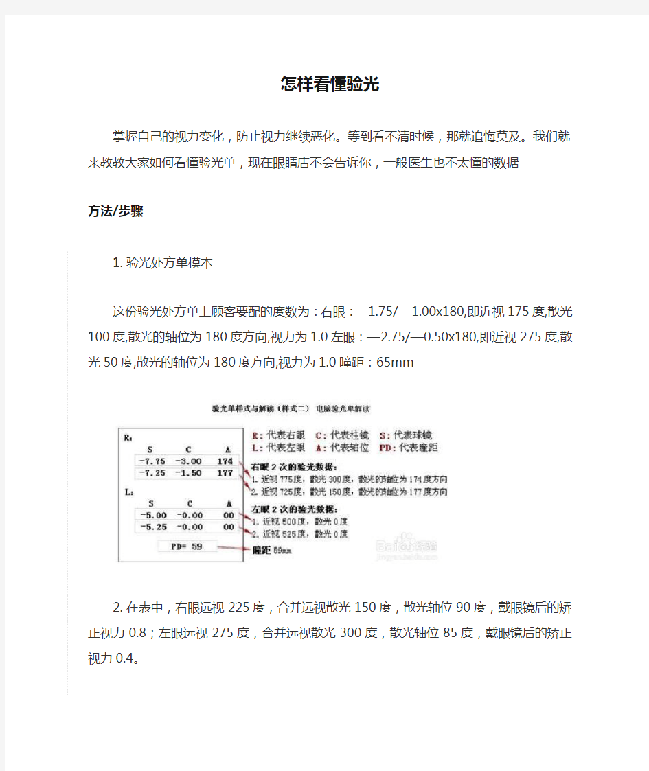 怎样看懂验光单