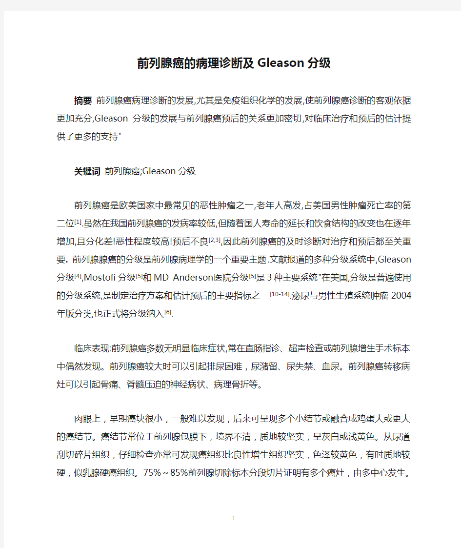 前列腺癌的病理诊断及Gleason分级