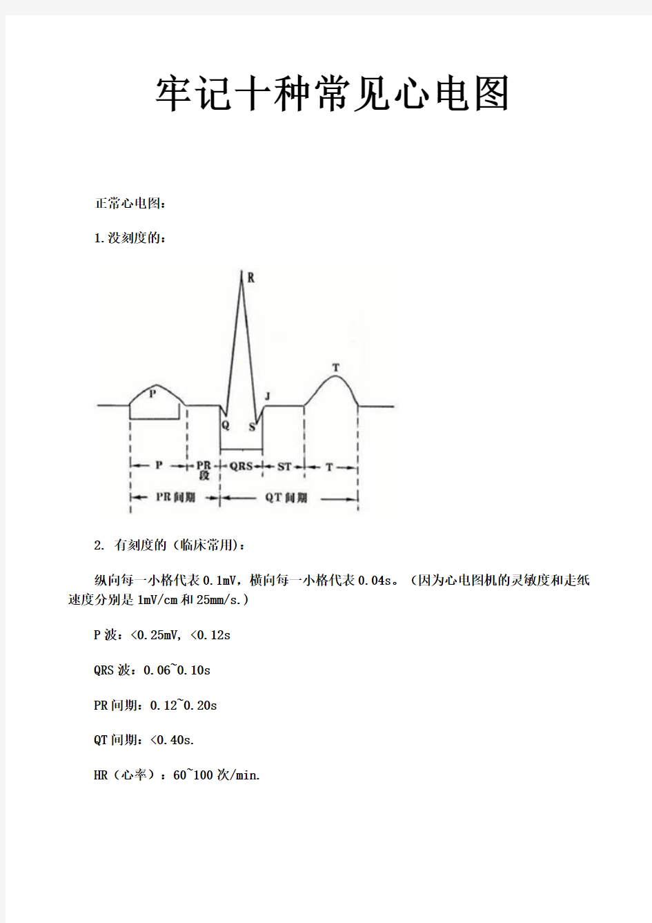 牢记十种常见心电图