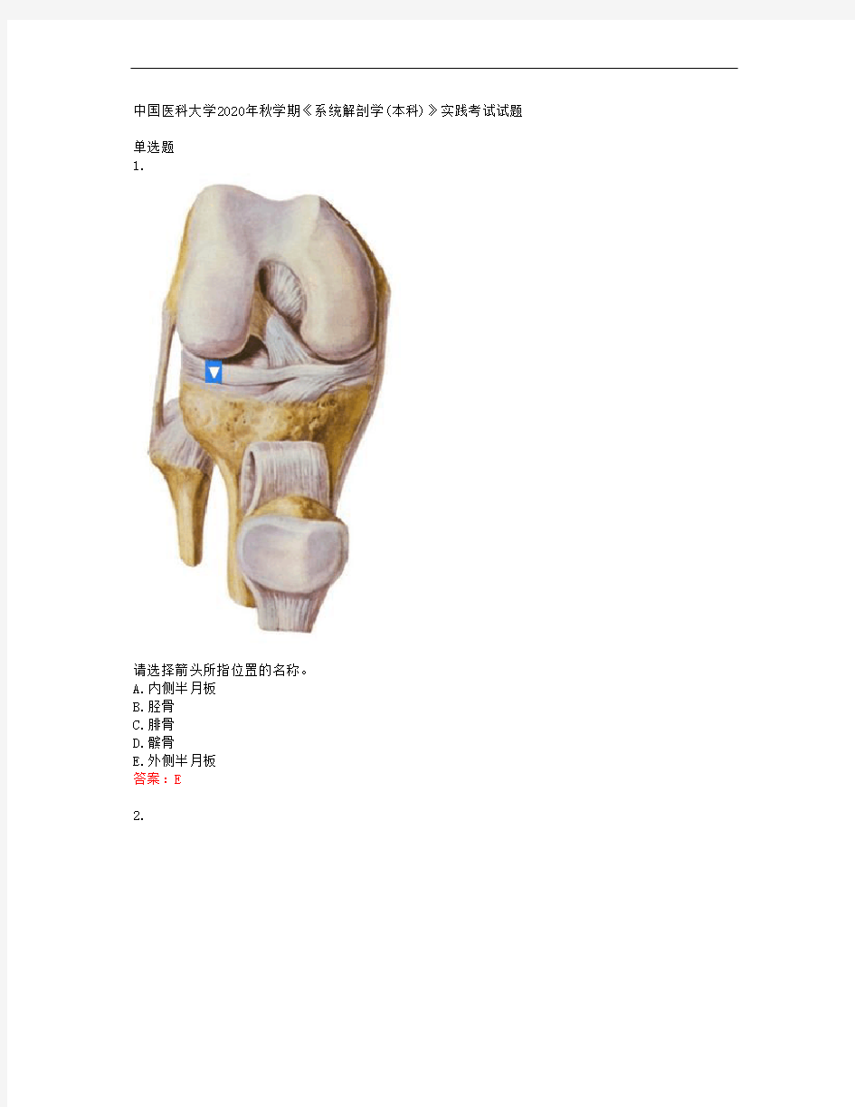 中国医科大学2020年秋学期《系统解剖学(本科)》实践考试试题