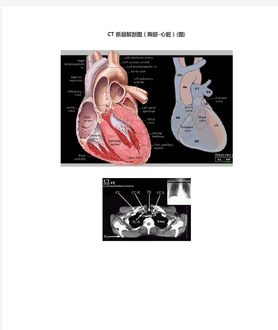 CT断层解剖图(心脏)