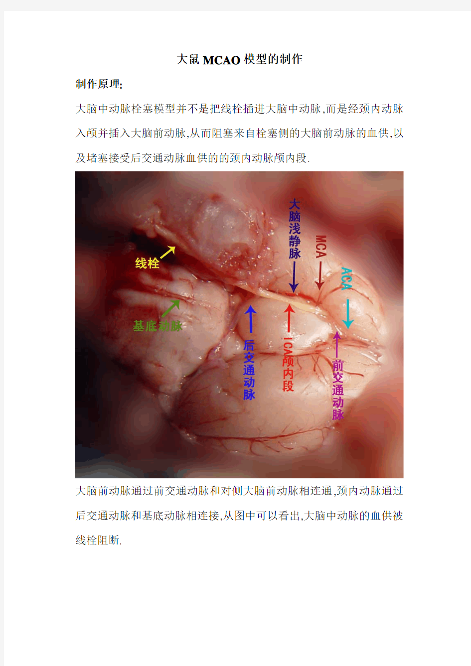 大鼠MCAO模型制作学习(第二版)