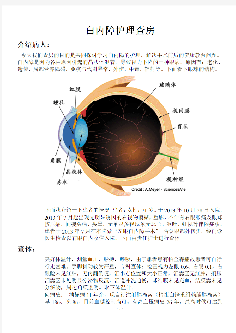 白内障护理查房