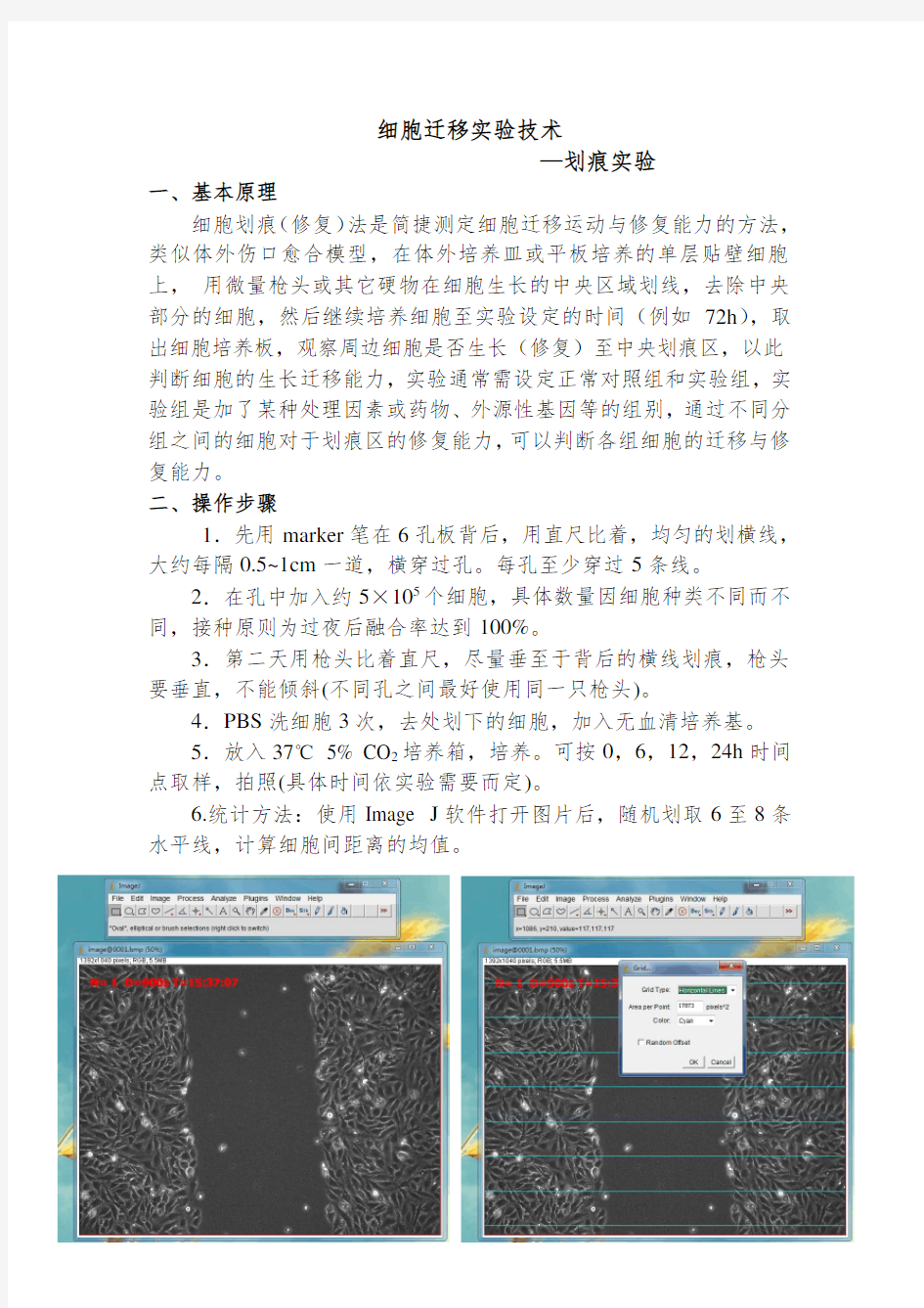 细胞迁移-划痕实验1